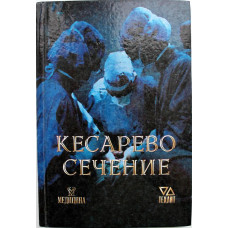 В. Краснопольский «КЕСАРЕВО СЕЧЕНИЕ»